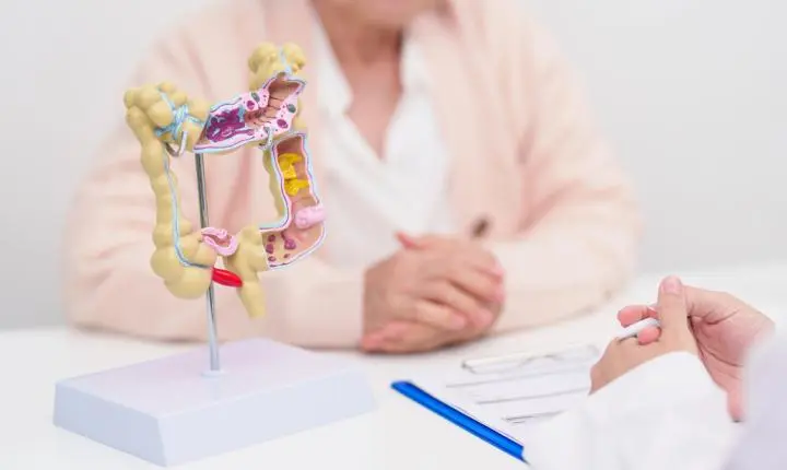 Um avanço na detecção do câncer de intestino